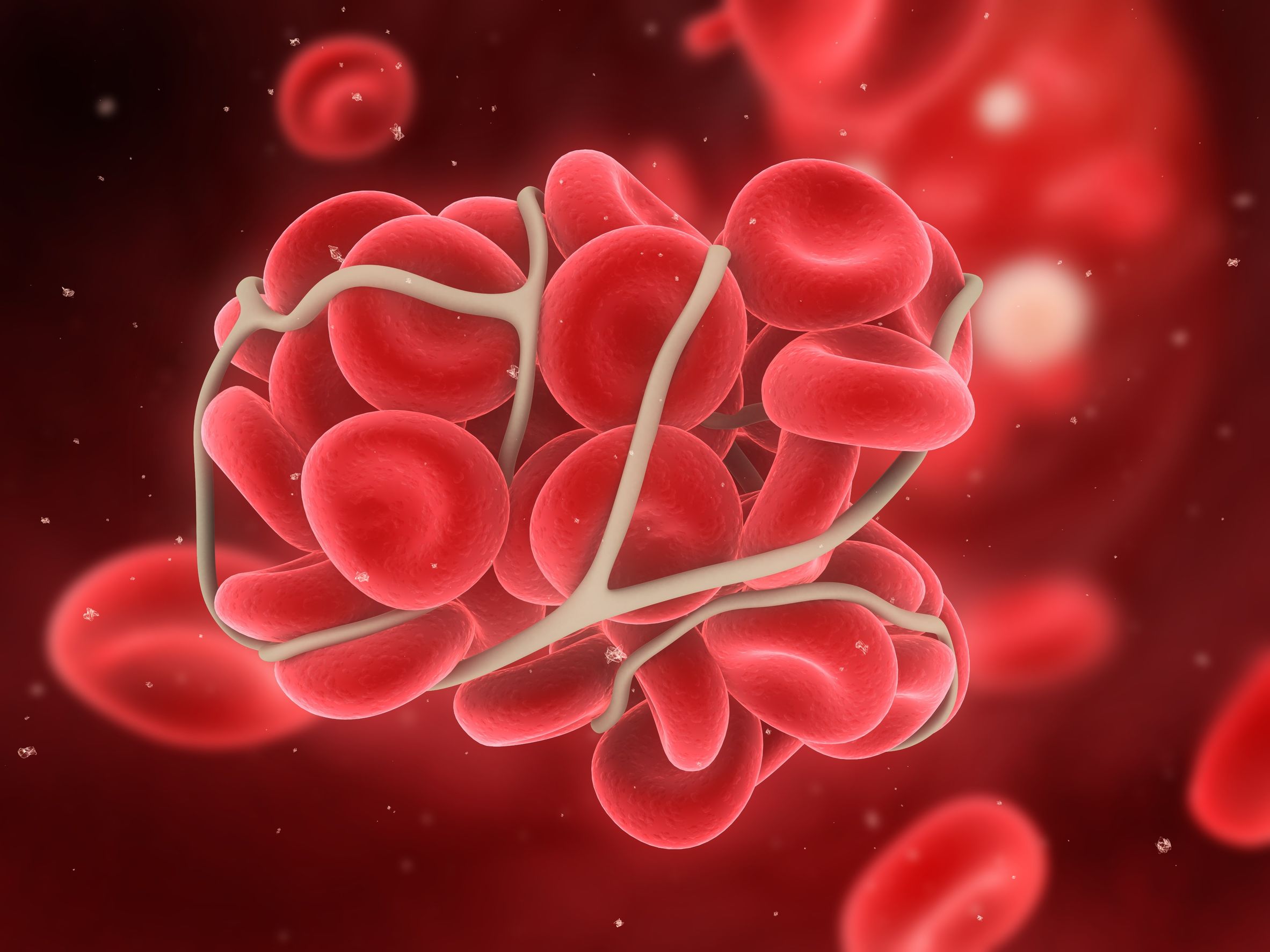 ivc-filters-become-more-dangerous-the-longer-they-are-in-place-us