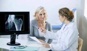 Talking to a Doctor about Hip Implant Issue